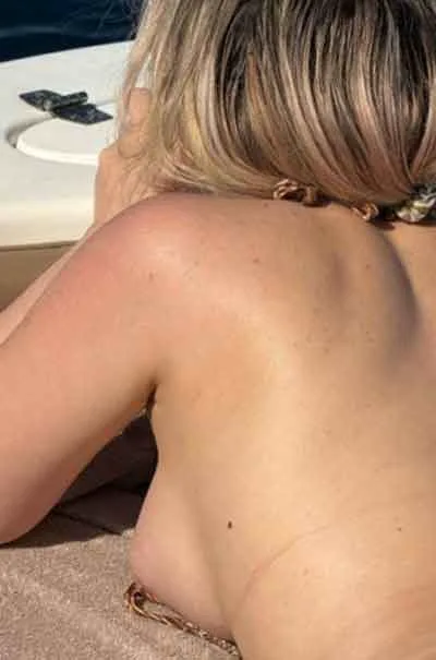 Hanna, 30 år